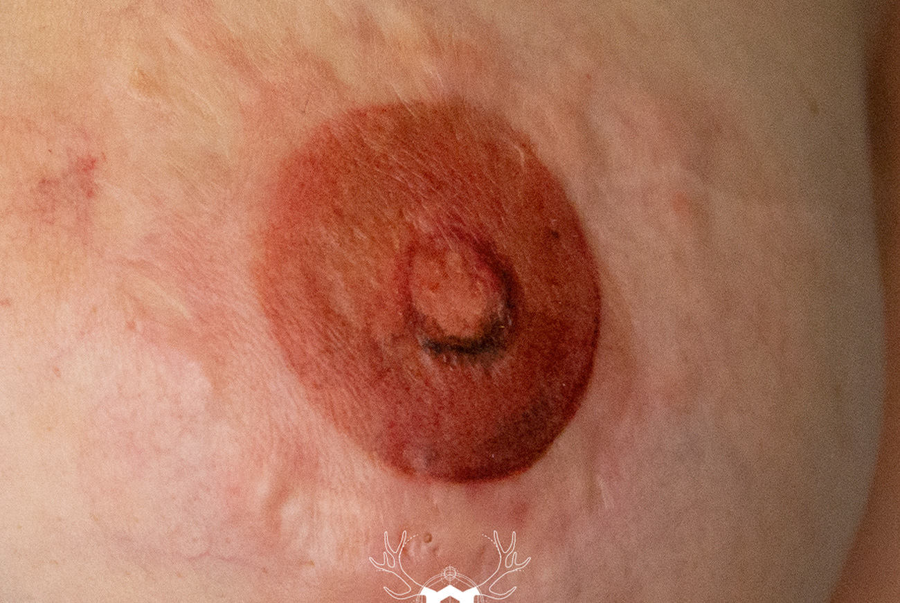 After